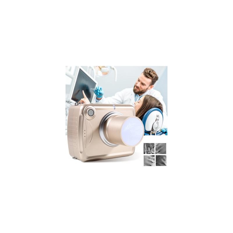 Unidad de rayos X dental portátil digital de mano de alta frecuencia