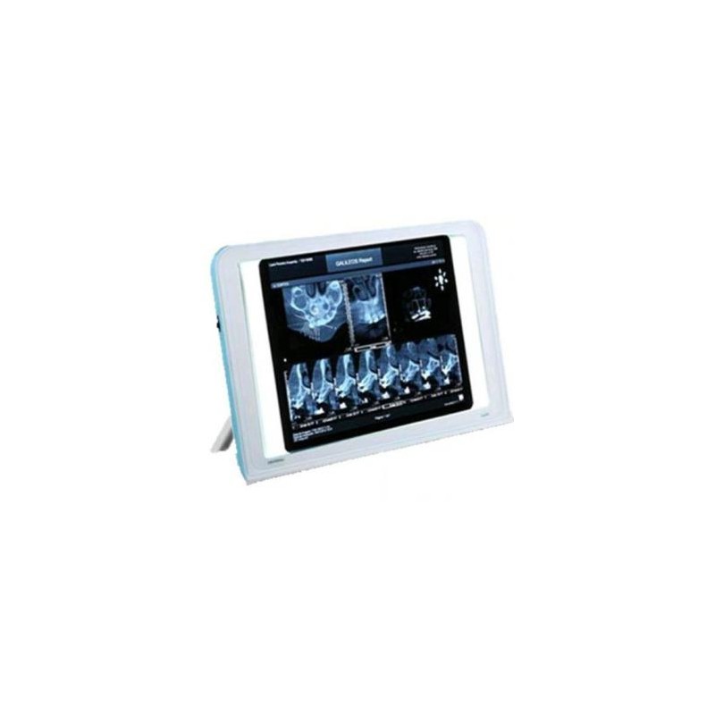Dental X-Ray Tipo de Cine de Visor de Cajas de la Vista la Pared del LED Iluminado Turística de Montaje Luna